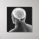 Buscar cerebro lienzos Médico