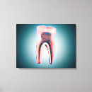 Buscar vasos sanguíneos lienzos Ilustracion