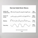 Buscar epilepsia posters Salud