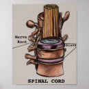 Buscar médula espinal posters Columna vertebral