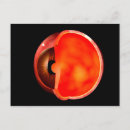 Buscar oftalmología postales Ojos