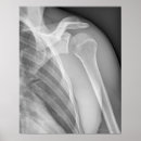 Buscar radiografía arte Blanco y negro