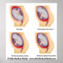 Buscar obstetricia posters Ginecología