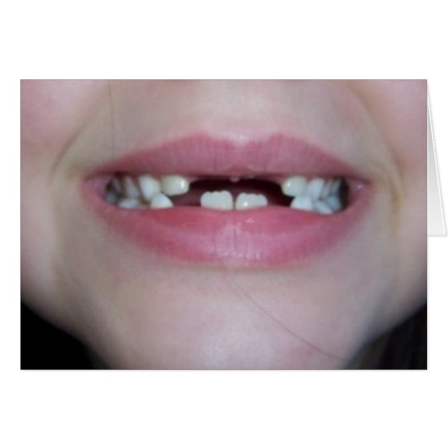 10.º dentadura (Anverso (Horizontal))