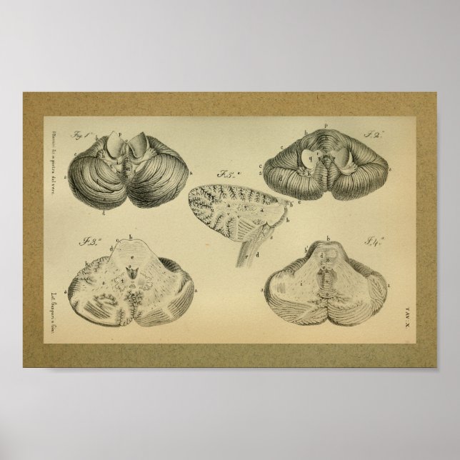1850 Cerebello de la impresión de anatomía vendimi (Frente)
