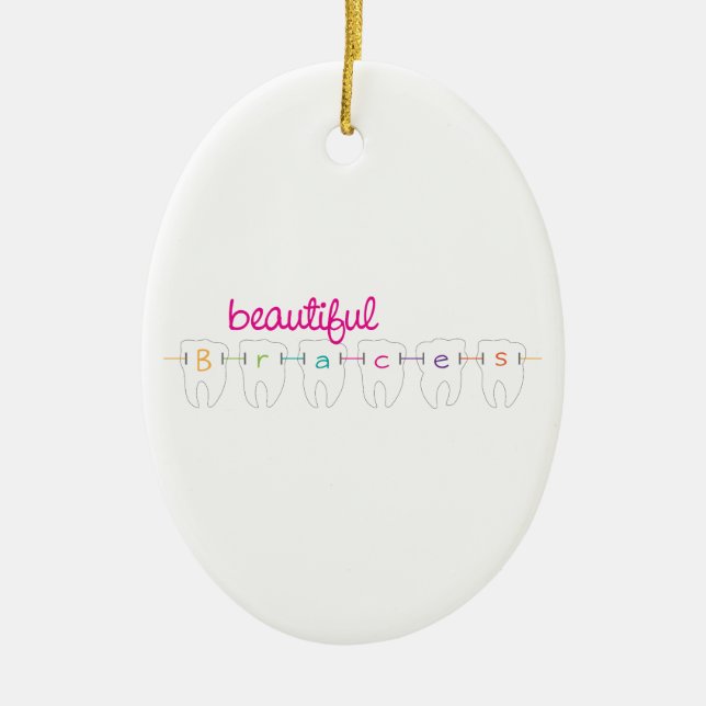 Adorno De Cerámica Apoyos hermosos (Frente)