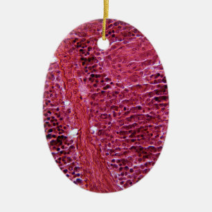 Adorno De Cerámica Células del páncreas debajo del microscopio