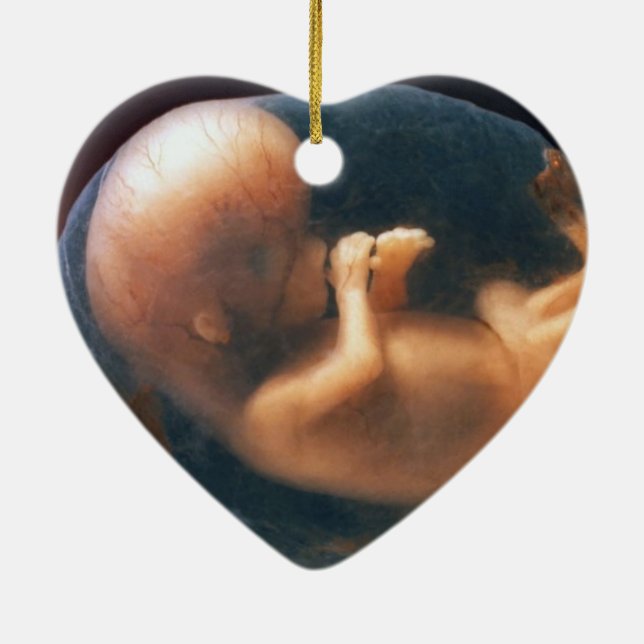 ADORNO DE CERÁMICA CRUSADOR PRO LIFE (Atrás)