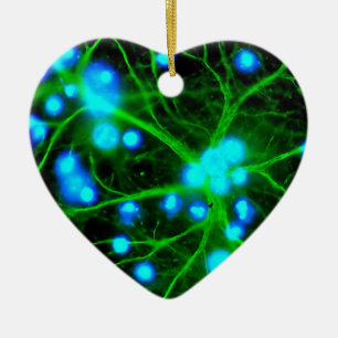 Adorno De Cerámica El Astrocyte es células de Glial asteroides en el