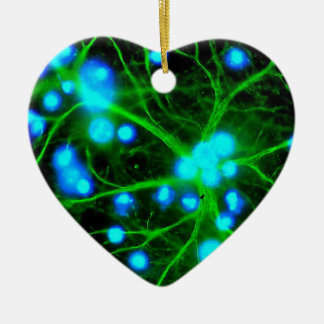 Adorno De Cerámica El Astrocyte es células de Glial asteroides en el