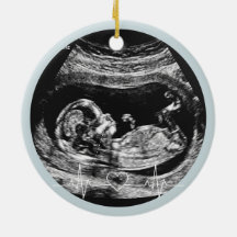 Es un Niño Anuncio de Embarazo por Ultrasonido Beb