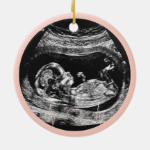 Es una niña Anuncio de Embarazo de Ultrasonido Beb