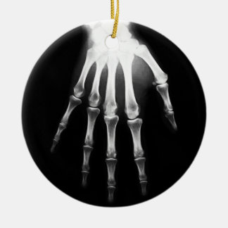 Adorno De Cerámica Médica médico de rayos X - Mano de rayos X del hos