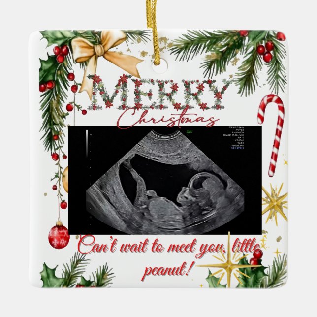 Adorno De Cerámica Merry Christmas Pregnancy Ultrasound (Anverso)