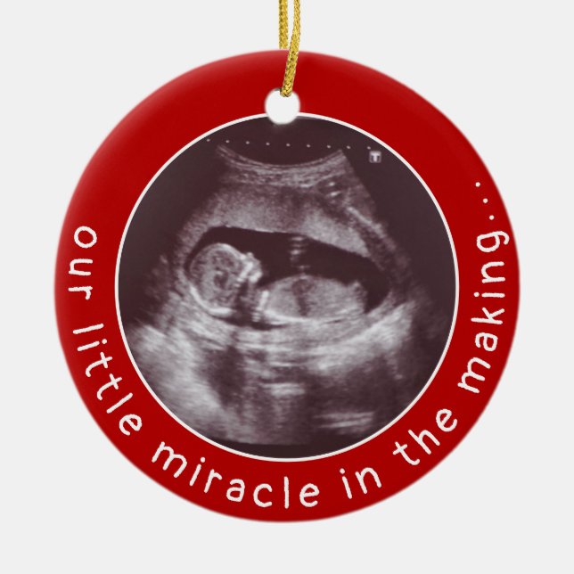 Adorno De Cerámica Navidades del Milagro Rojo por Ultrasonido Bebé (Frente)