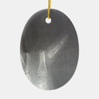 Adorno De Cerámica Radiografía