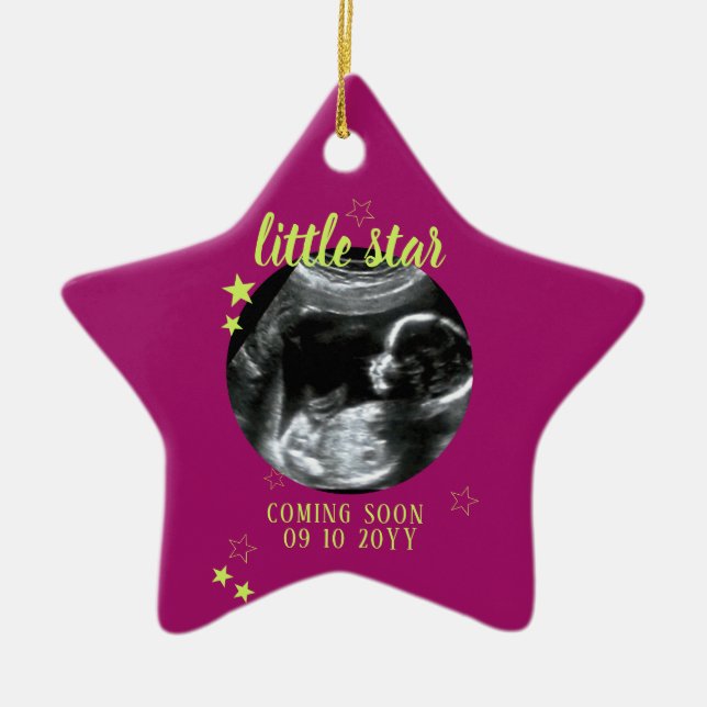Adorno De Cerámica Sonograma Keepsake Baby Ultrasonido (Frente)