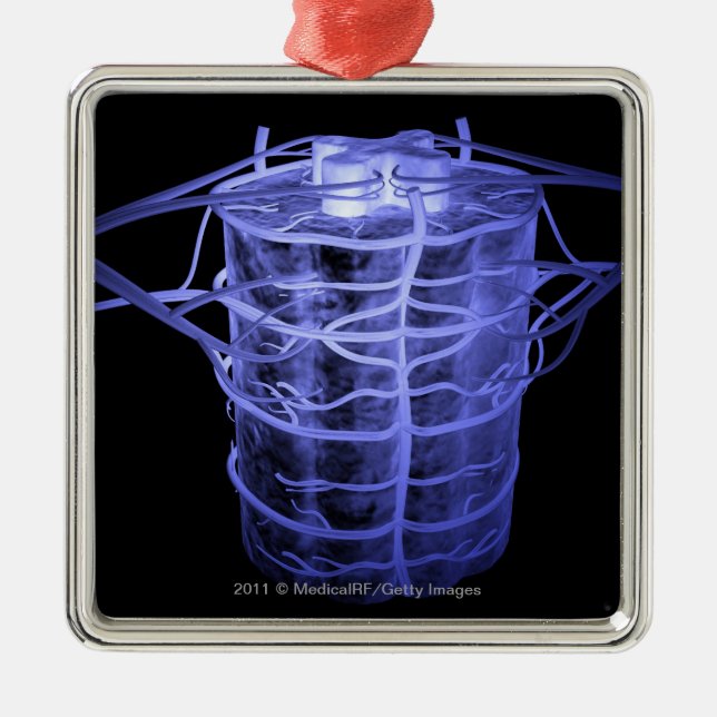 Adorno Metálico Arterias que rodean la parte de la columna espinal (Frente)