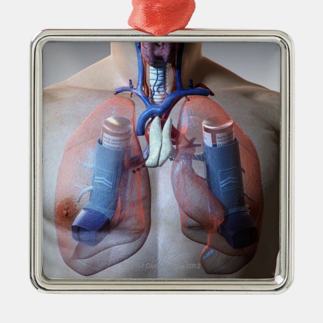 Adorno Metálico Asma (Frente)