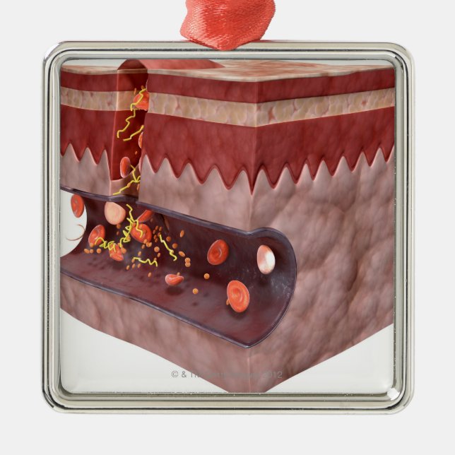 Adorno Metálico Formación del coágulo de sangre (Frente)