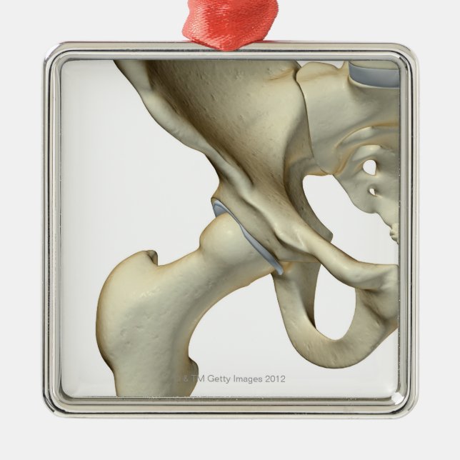 Adorno Metálico Huesos de la cadera 5 (Frente)