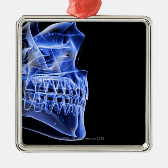 Adorno Metálico Huesos del mandíbula (Frente)