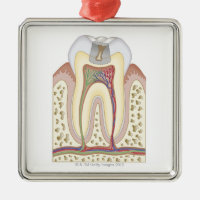 Ilustracion de la caries