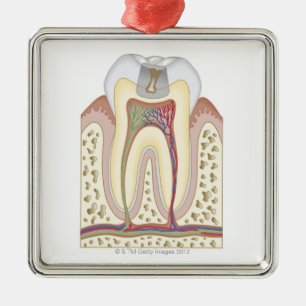 Adorno Metálico Ilustracion de la caries
