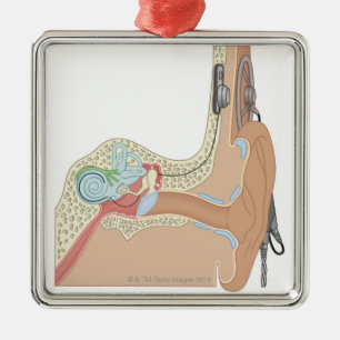 Adorno Metálico Implantes cocleares