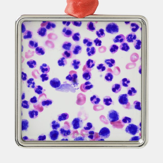 Adorno Metálico Infección de la staph (Frente)