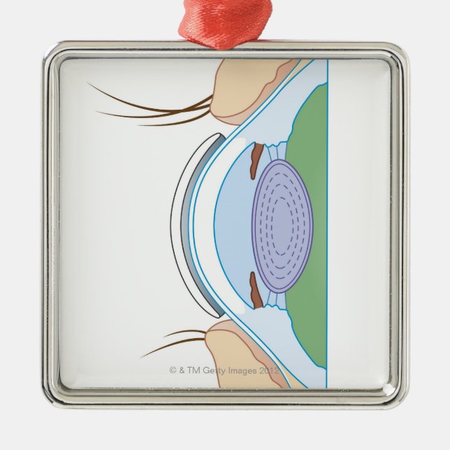 Adorno Metálico Lente de contacto suave (Frente)