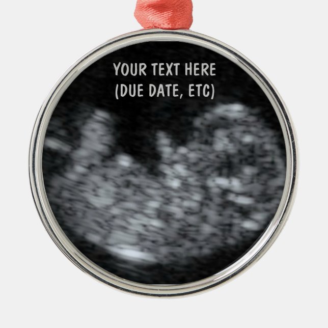Adorno Metálico Personalizado Baby Ultrasound Photo (Frente)