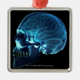 Adorno Metálico Radiografía del cerebro dentro de un cráneo