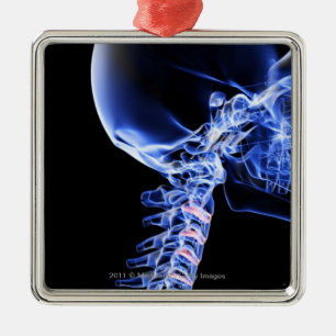 Adorno Metálico Radiografíe la imagen de los huesos del cuello