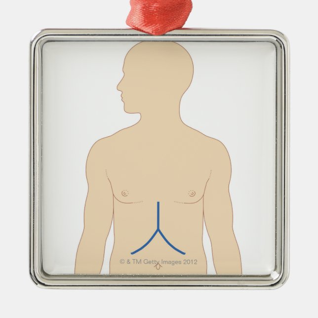 Adorno Metálico Trasplante del hígado (Frente)