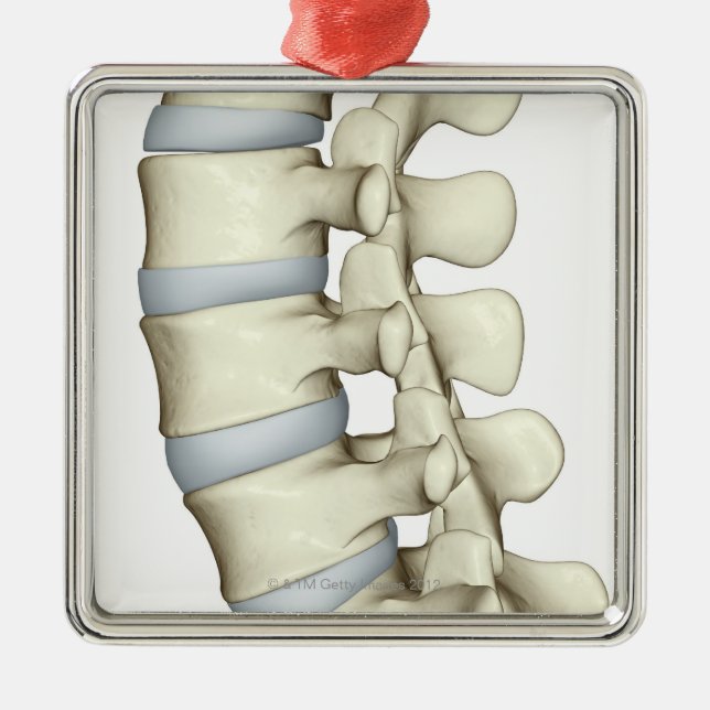 Adorno Metálico Vértebras lumbares (Frente)