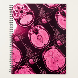 Agenda Magenta MRI: Una visión axial del cerebro