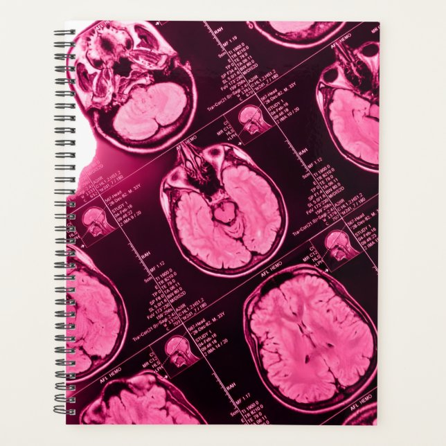 Agenda Magenta MRI: Una visión axial del cerebro (Anverso)