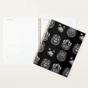 Agenda Resonancia magnética cerebral