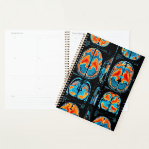 Agenda Revisión cerebral por resonancia magnética