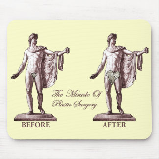 Alfombrilla De Ratón Antes y después