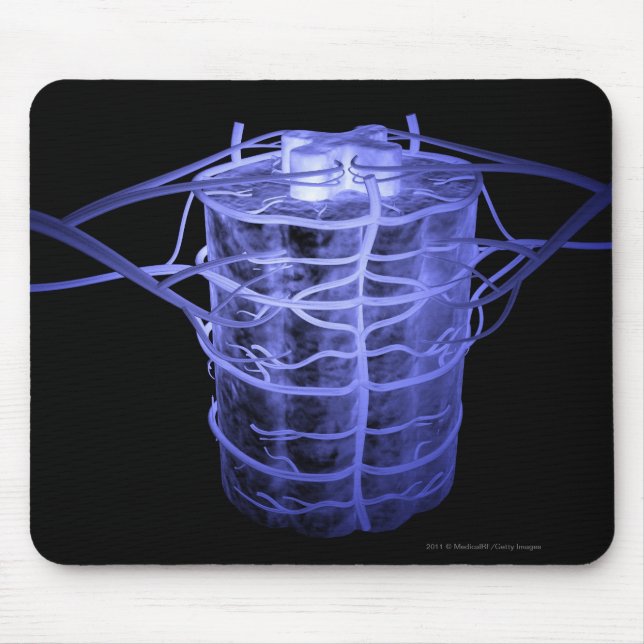 Alfombrilla De Ratón Arterias que rodean la parte de la columna espinal (Frente)
