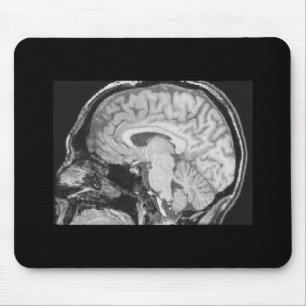 Alfombrilla De Ratón Cerebro MRI