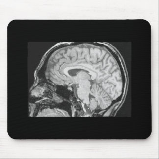 Alfombrilla De Ratón Cerebro MRI