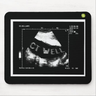 Alfombrilla De Ratón CT Ondulas Mousepade (CT Ondulas en la barriga)