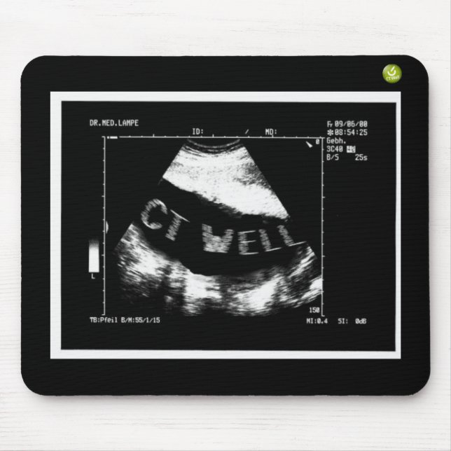 Alfombrilla De Ratón CT Ondulas Mousepade (CT Ondulas en la barriga) (Frente)