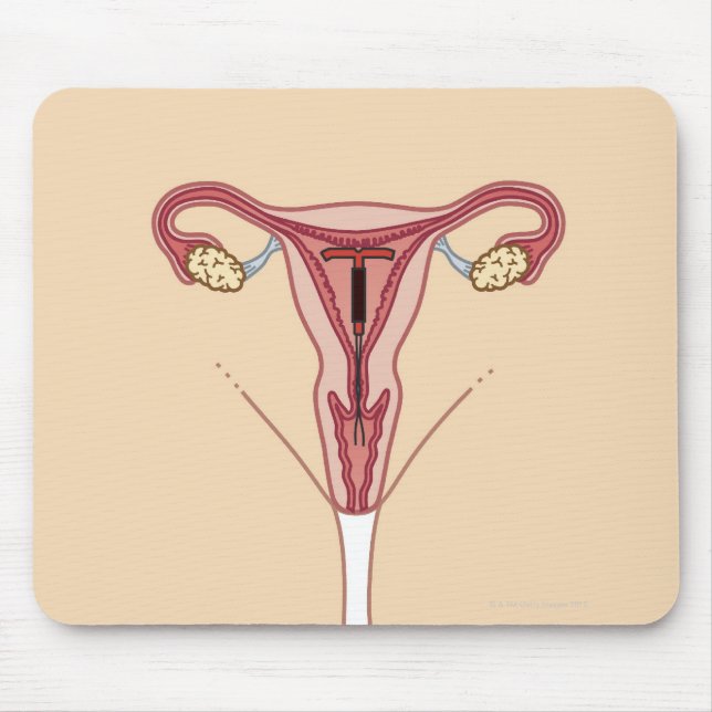 Alfombrilla De Ratón Dispositivo intrauterino (Frente)