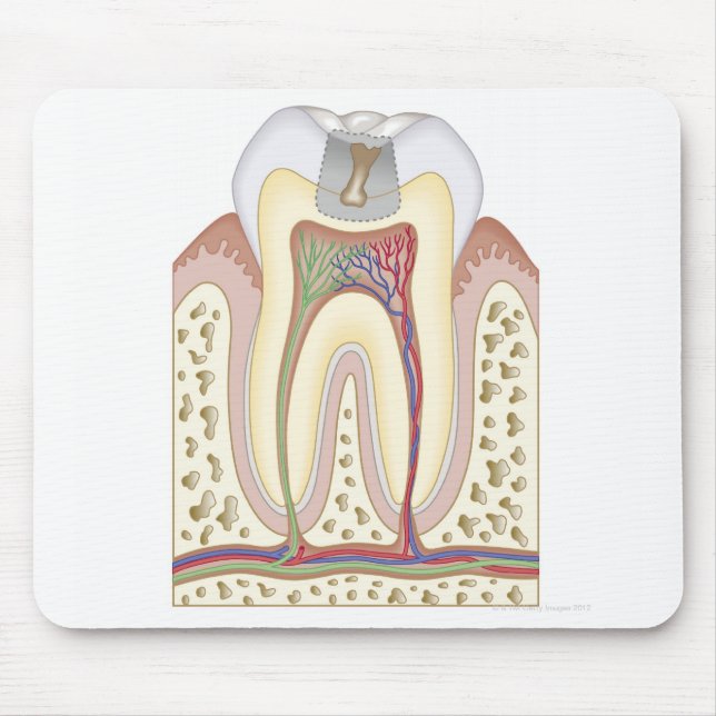 Alfombrilla De Ratón Ilustracion de la caries dental (Frente)
