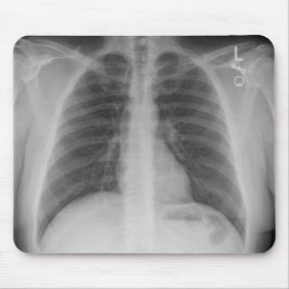 Alfombrilla De Ratón Mousepad de rayos X