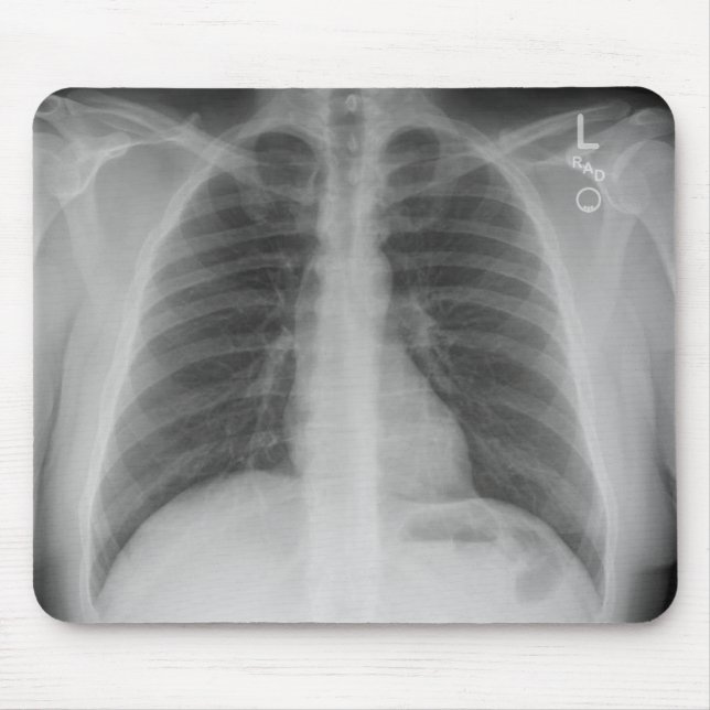 Alfombrilla De Ratón Mousepad de rayos X (Frente)